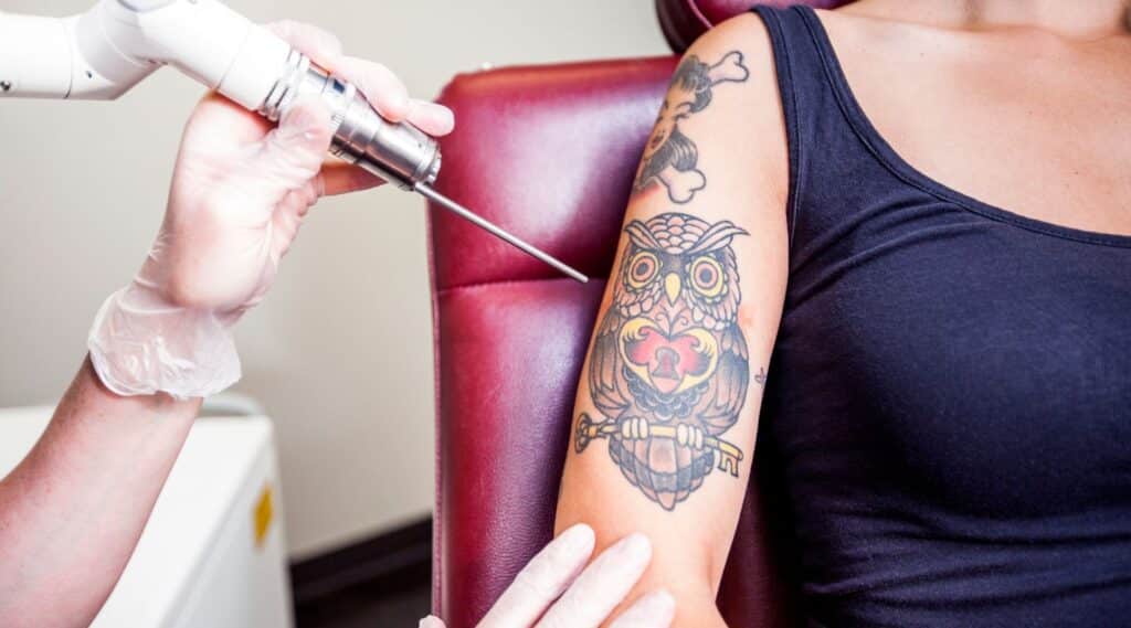 Tattoo Removal Methods featured image